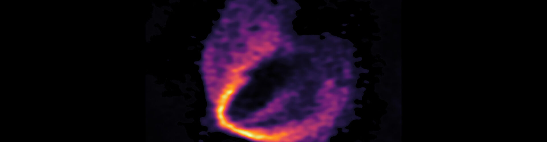 ALMA Discovers Trio of Infant Planets around Newborn Star