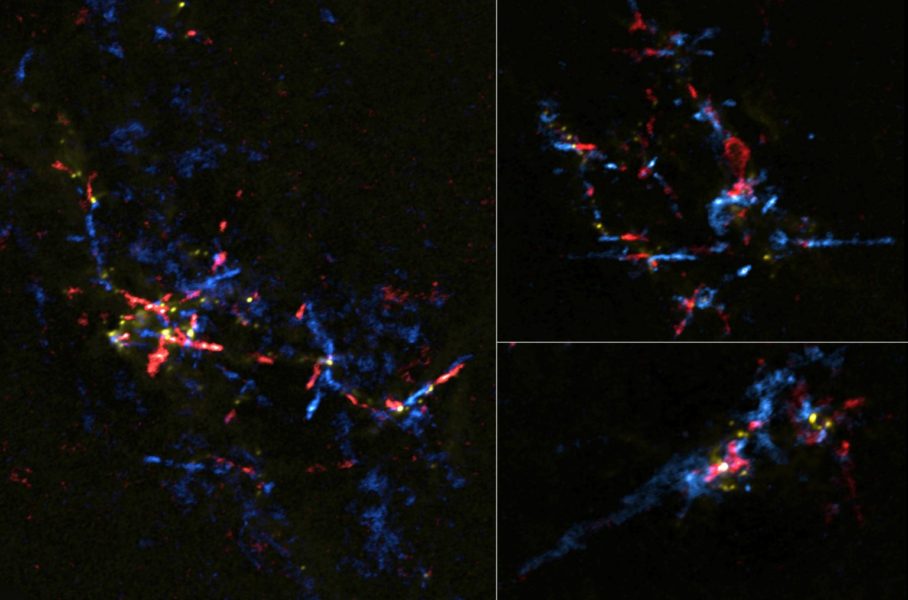 Stellar Eggs near Galactic Center Hatching into Baby Stars