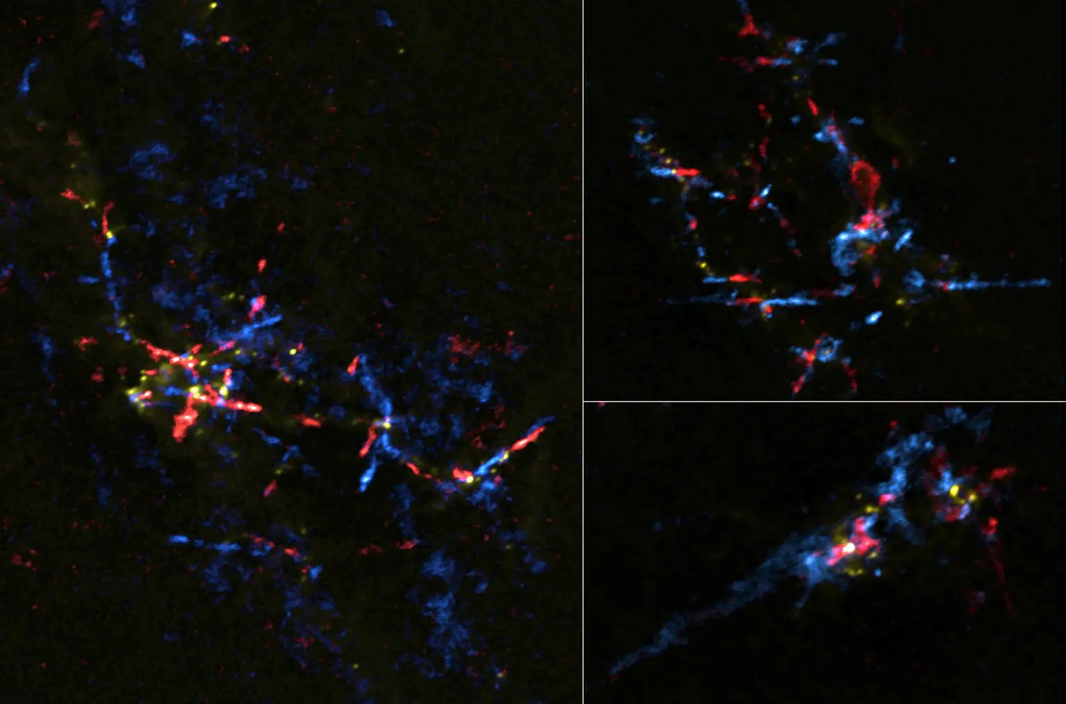 Stellar Eggs near Galactic Center Hatching into Baby Stars